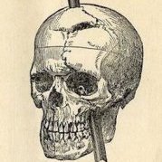 PhineasGage